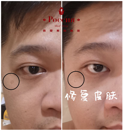 case-study